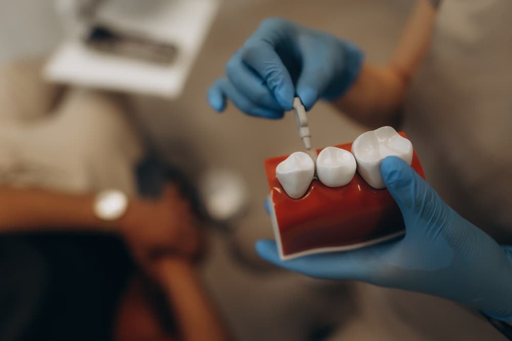 Dentist explaining a dental procedure, using a model of molars to demonstrate filling or crown placement.